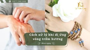 dị ứng vòng trầm hương