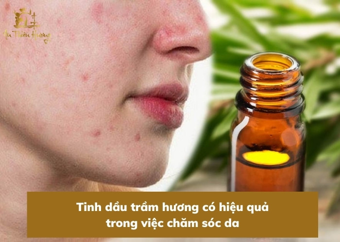 Tinh Dầu Trầm Hương: Những tác dụng đối với sức khỏe 4 tinh dầu trầm hương